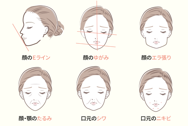 矯正治療で期待できる口ゴボ改善・Eライン等