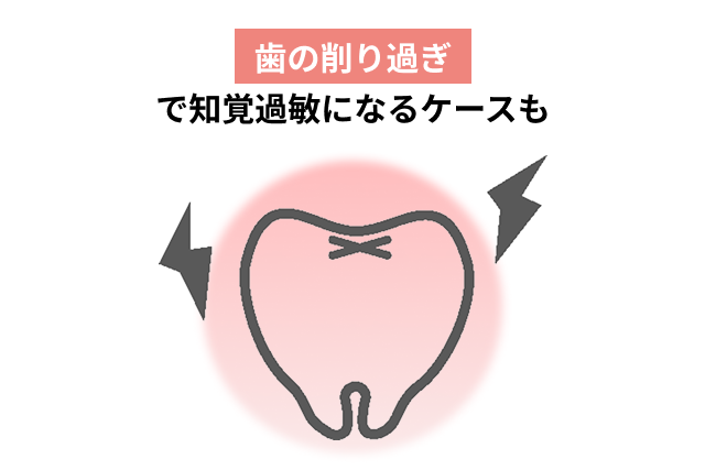 歯の削り過ぎで知覚過敏になるケース